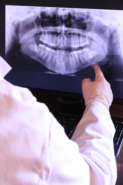 Best Emergency Treatment for Dental Infections or Abscesses in Treasure Island, FL